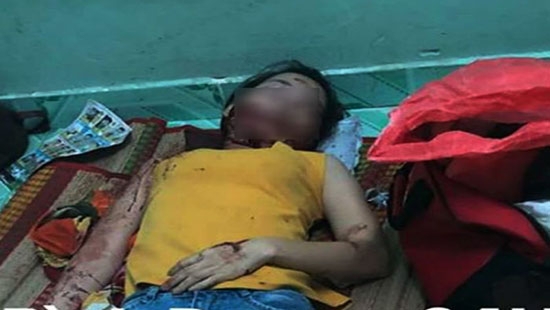 Người chồng vũ phu chém vợ trọng thương trong phòng trọ