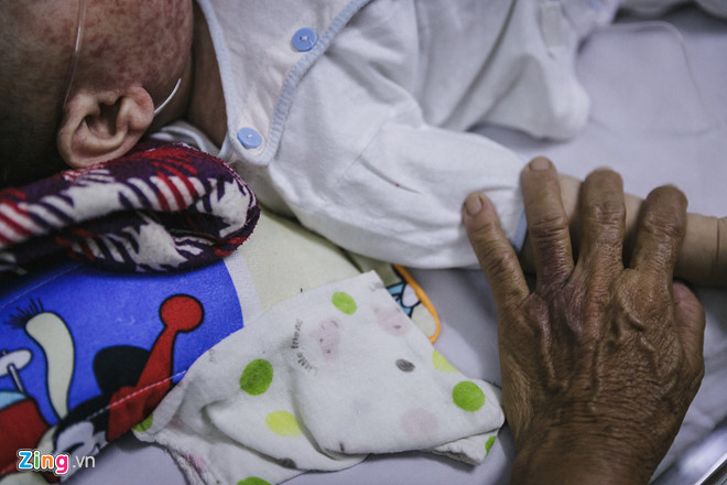 Dịch bệnh như sởi, ho g&agrave;, tay ch&acirc;n miệng ho&agrave;nh h&agrave;nh dịp Tết Nguy&ecirc;n đ&aacute;n. Ảnh:&nbsp;Li&ecirc;u L&atilde;m.