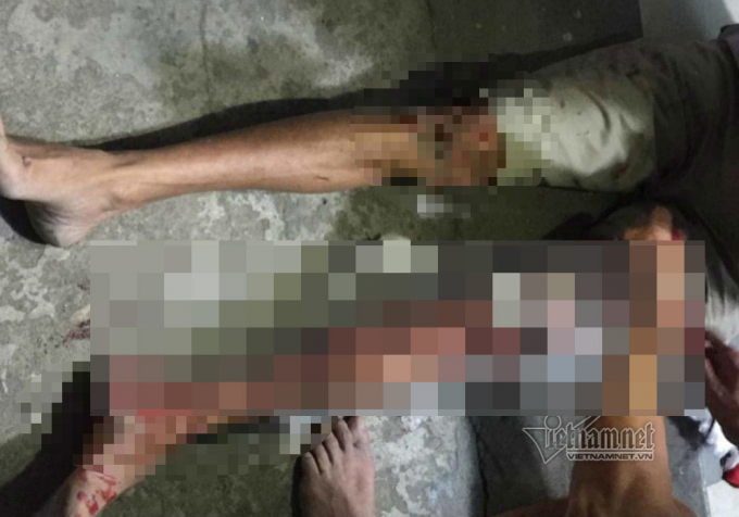 Nạn nh&acirc;n An bị đ&acirc;m đứt g&acirc;n ch&acirc;n, bố mẹ cũng bị đ&aacute;nh trọng thương