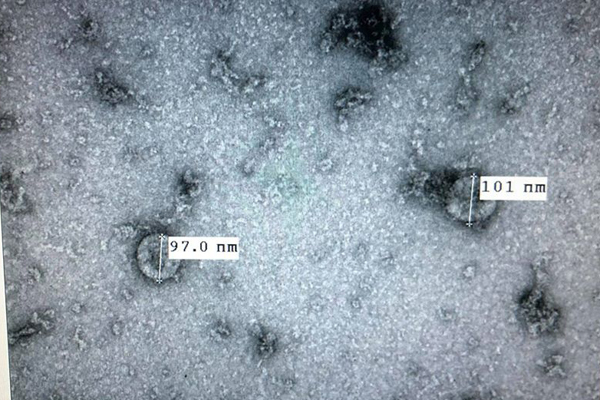 viet-nam-nuoi-cay-phan-lap-thanh-cong-virus-corona-moi-1