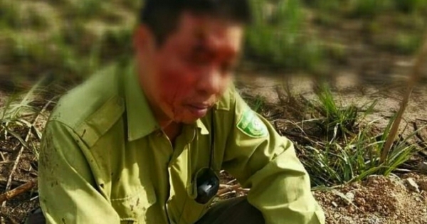 Làm rõ vụ kiểm lâm bị đánh toác đầu ở Đắk Lắk