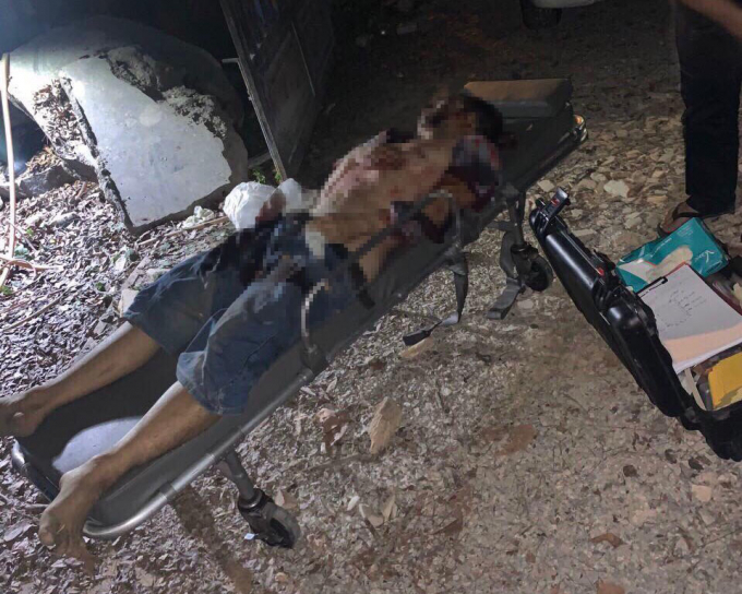 Thi thể đối tượng Lê Quốc Tuấn sau khi bị tiêu diệt.