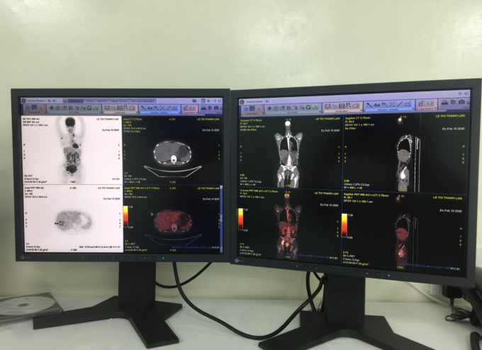 Hệ thống điều hành chụp PET/CT tại bênh viện ung bướu TP.HCM. Ảnh: Thanh Hải