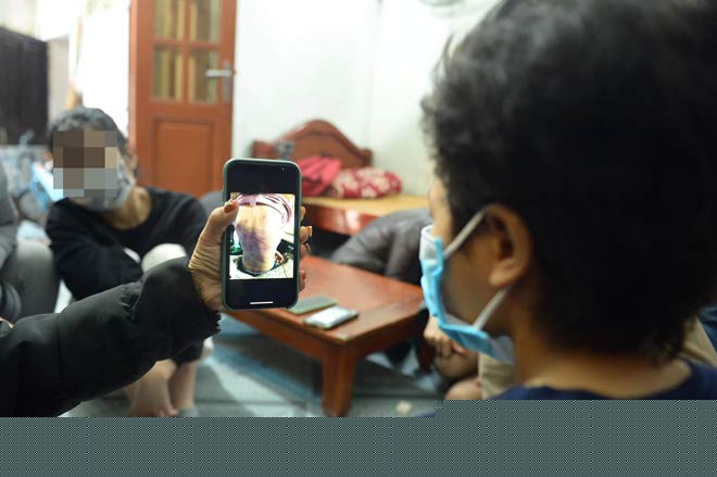 Khi nhìn lại hình ảnh em bị đánh bầm tím B. không khỏi rùng mình