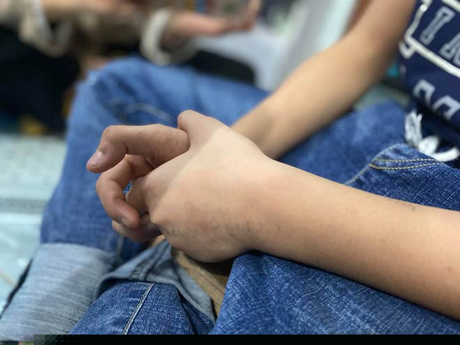 Lúc kể lại sự việc đôi tay của B. run rẩy đan vào nhau khi nhắc lại chuyện cũ.