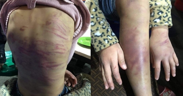 Khởi tố 2 đối tượng trong vụ bé gái 12 tuổi nghi bị bạo hành và xâm hại tình dục ở Hà Đông