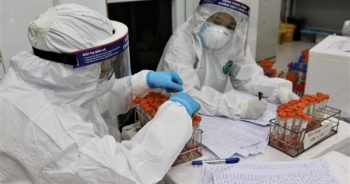 Ít nhất 15 - 16% dân số Việt Nam được tiêm vaccine COVID-19 miễn phí