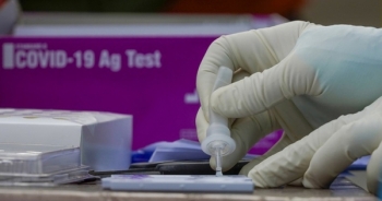 Dấu hiệu nhận biết trẻ mắc Covid-19