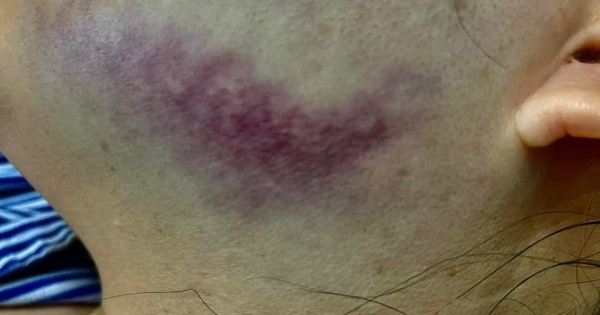 Cơ quan CSĐT Công an TP Hạ Long vào cuộc vụ Trưởng phòng công chứng bị hành hung