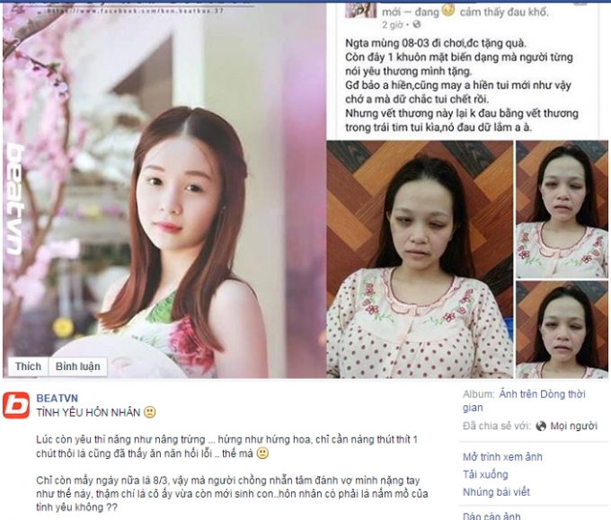 T&acirc;m sự của người phụ nữ bị chồng đ&aacute;nh đến biến dạng khu&ocirc;n mặt. Nguồn: Facebook.