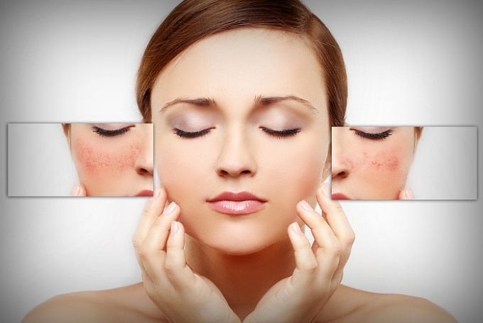 Vi&ecirc;n uống trắng da, trị n&aacute;m Gluta White Plus c&oacute; g&acirc;y t&aacute;c dụng phụ kh&ocirc;ng?