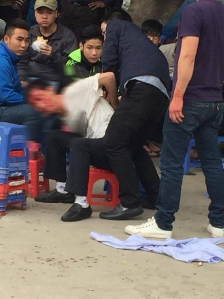 Vụ l&aacute;i xe biển xanh 80A c&ugrave;ng một nh&oacute;m người h&agrave;nh hung anh Nh. diễn ra trước sự chứng kiến của nhiều người. Sau một th&aacute;ng, danh t&iacute;nh những đối tượng h&agrave;nh hung vẫn bặt v&ocirc; &acirc;m t&iacute;n.