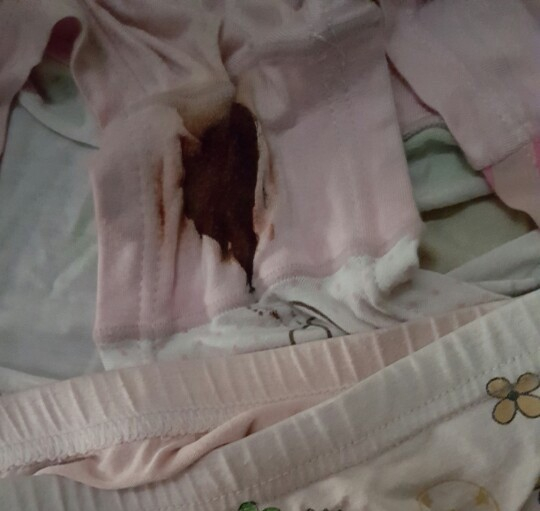 Quần ch&aacute;u b&eacute; bị d&iacute;nh m&aacute;u ở vị tr&iacute; v&ugrave;ng k&iacute;n.