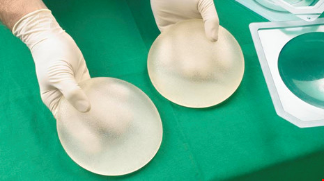 Cảnh b&aacute;o th&ecirc;m 1 dạng ung thư nguy hiểm do n&acirc;ng ngực