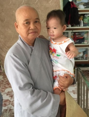 Sư c&ocirc; Huệ Đức v&agrave; một trẻ mổ c&ocirc;i.