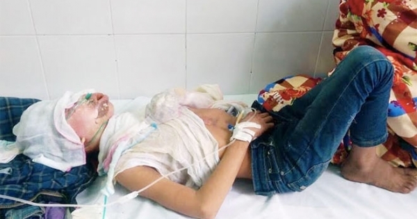 Quảng Ninh: Dạy con bằng xăng, 2 bé trai bỏng nặng