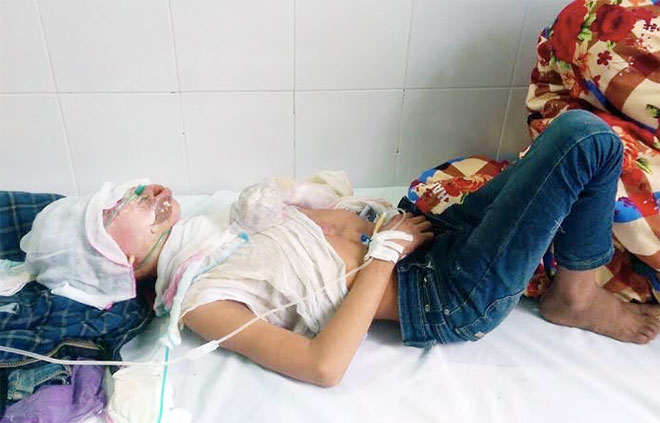 Nạn nh&acirc;n đang điều trị tại Trung t&acirc;m y tế huyện Hải H&agrave; (Ảnh Thanh Trường, Trung t&acirc;m TT &amp;amp;amp; VH Hải H&agrave;).