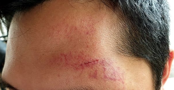 Hà Nội: Điều tra vụ phóng viên Tạp chí Thương trường bị hành hung