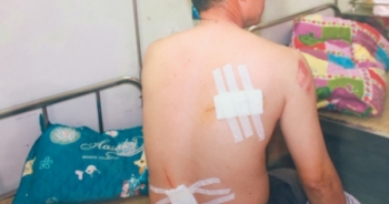 Ninh Bình: Phụ xe côn đồ, cầm kiếm chém người trọng thương tại bến xe