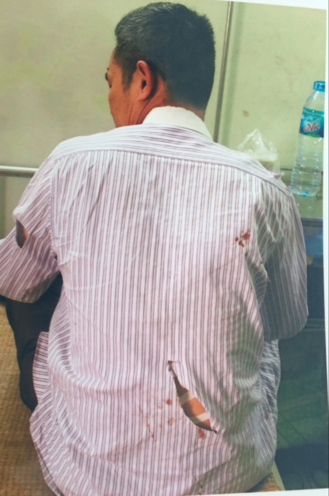 Ninh B&igrave;nh: Phụ xe c&ocirc;n đồ, cầm kiếm ch&eacute;m người trọng thương tại bến xe