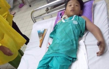 Ra đồng bắt cua cùng bố, bé trai 11 tuổi bị rắn hổ mang cắn nguy kịch