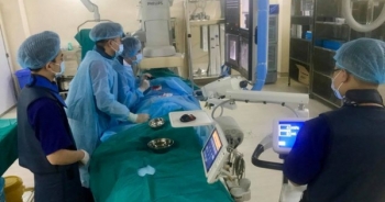 Loại bỏ khối u gan lớn đến 6cm không cần phẫu thuật