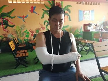 &Ocirc;ng Sơn bị đ&aacute;nh g&atilde;y xương tay phải, đa chấn thương phần mềm.