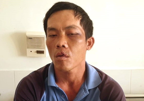 Anh Phương khi đang điều trị tại Bệnh viện Đa khoa tỉnh Ph&uacute; Y&ecirc;n.