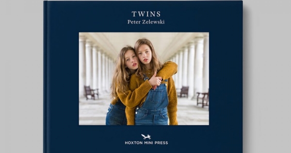 Bí ẩn về mối liên kết của những cặp song sinh