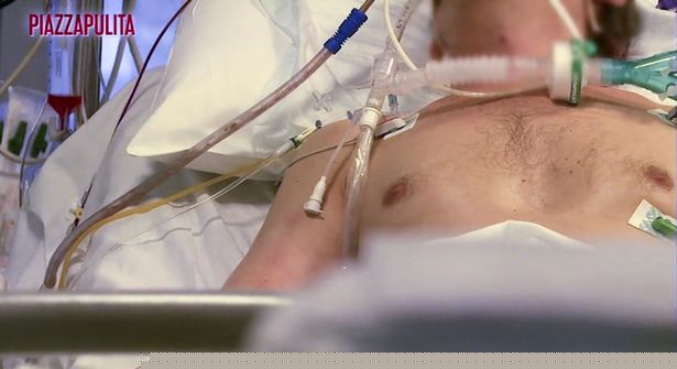 hinh anh soc trong phong benh dac biet cua benh nhan covid-19 hinh anh 4