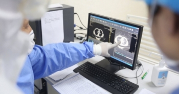 Covid-19 đã "ăn" phổi người bệnh như thế nào?