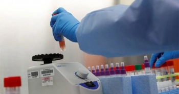 Bác gái bệnh nhân 17 bệnh chuyển nặng, phải thở máy, lọc máu liên tục