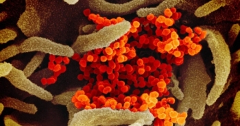 Giải đáp thắc mắc thường gặp về virus gây dịch Covid - 19