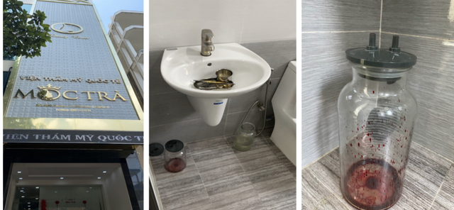 Một cơ sở chăm sóc da nhưng lại có các dụng cụ phẫu thuật đã qua sử dụng tại “Viện Thẩm mỹ Quốc tế Mộc Trà”. Ảnh: Thanh tra sở Y tế TP HCM.