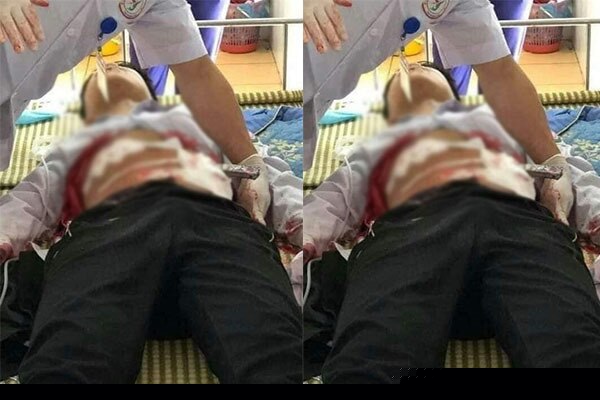 Nam sinh P. bị bạn đâm phải nhập viện cấp cứu. Ảnh MXH