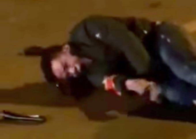 Thượng úy công an bị thanh niên đi xe máy tông gục dưới đường.