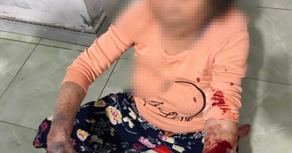 Hải Phòng: Triệu tập người đàn ông đánh cụ bà 83 tuổi nhập viện