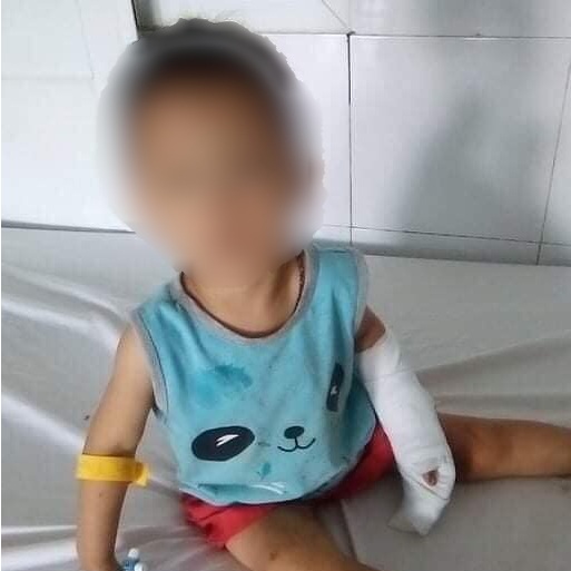 Níu kéo người yêu bất thành, gã đàn ông cắt đứt gân tay cháu bé 4 tuổi - 1