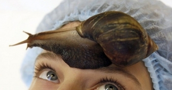 Dùng ốc sên làm đẹp lợi bất cập hại