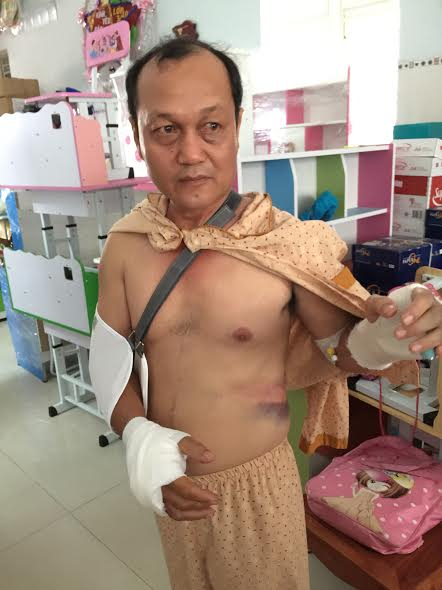 Nạn nh&acirc;n nhập viện điều trị sau khi bị tấn c&ocirc;ng.