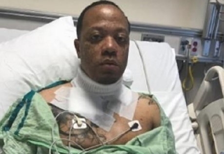 iPhone hở điện khiến nạn nhân bị giật, bỏng nặng nhiều chỗ