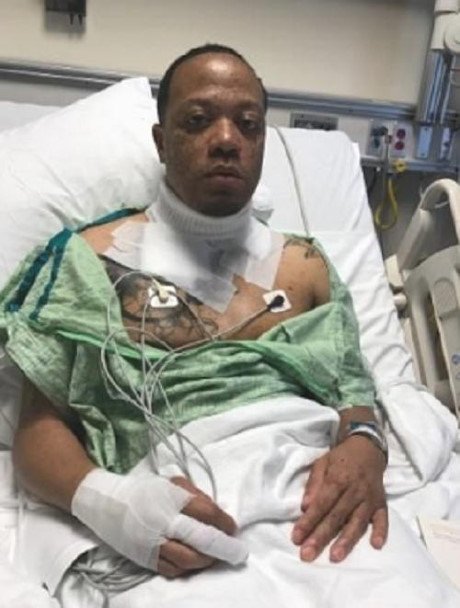 Anh Wiley Day phải nằm viện 3 ng&agrave;y v&igrave; sự cố bất ngờ do sạc iPhone g&acirc;y ra.