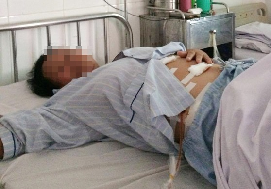 Hiện tại, sau ca phẫu thuật b&agrave; T đ&atilde; tỉnh lại, đang tiếp tục được theo d&otilde;i.