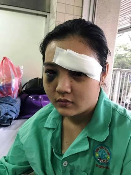 Nạn nh&acirc;n Tr&uacute;c.