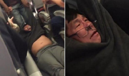 H&igrave;nh ảnh b&aacute;c sĩ Dao bị nh&acirc;n vi&ecirc;n h&atilde;ng&nbsp;United Airlines k&eacute;o đi.