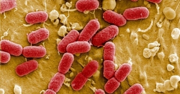 Việt Nam xuất hiện siêu vi khuẩn kháng tất cả kháng sinh