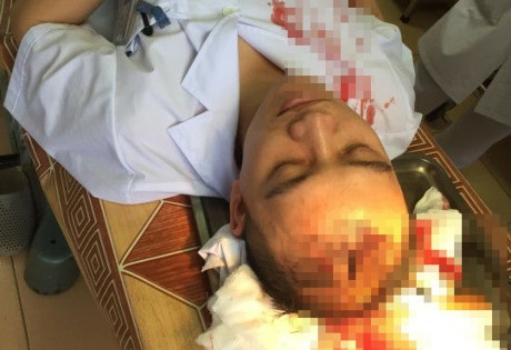 Hà Nội: Xác minh đối tượng hành hung bác sĩ ở Thạch Thất