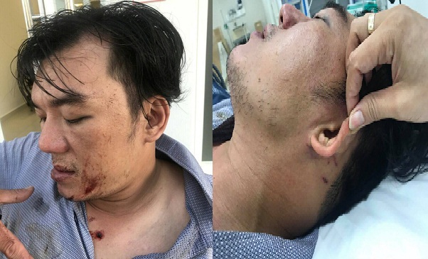 Anh Hiếu&nbsp;bị chấn thương n&atilde;o, lệch xương b&agrave;n tay, đa chấn thương v&ugrave;ng mặt, chấn thương v&ugrave;ng mang tai&hellip;&nbsp;