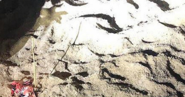 Cháu bé 7 tuổi bị bầy chó dữ cắn đã tử vong