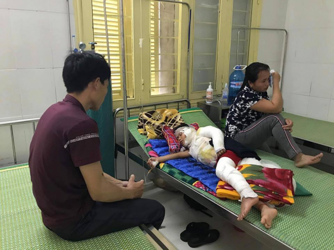 B&eacute; trai bị bỏng nặng to&agrave;n th&acirc;n, hiện đang được điều trị tại bệnh viện.
